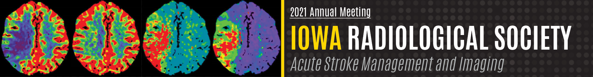 2021 Iowa Radiological Society Meeting:  Stroke Banner